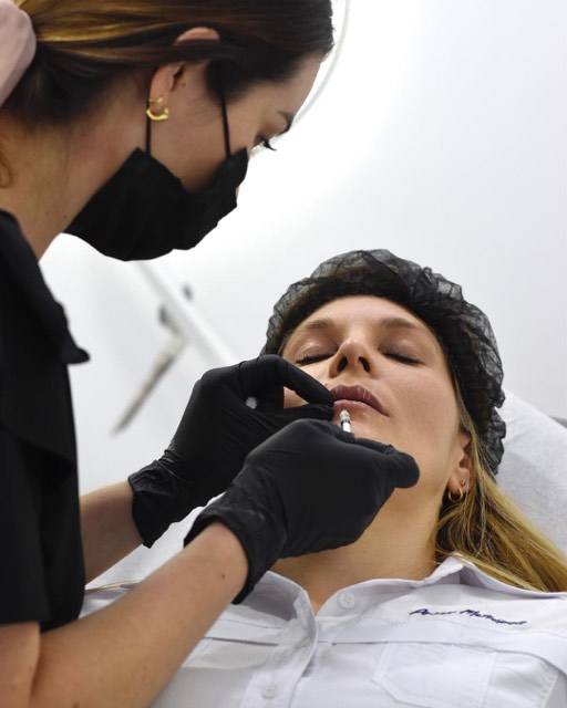Procedimiento médico con ácido hialurónico